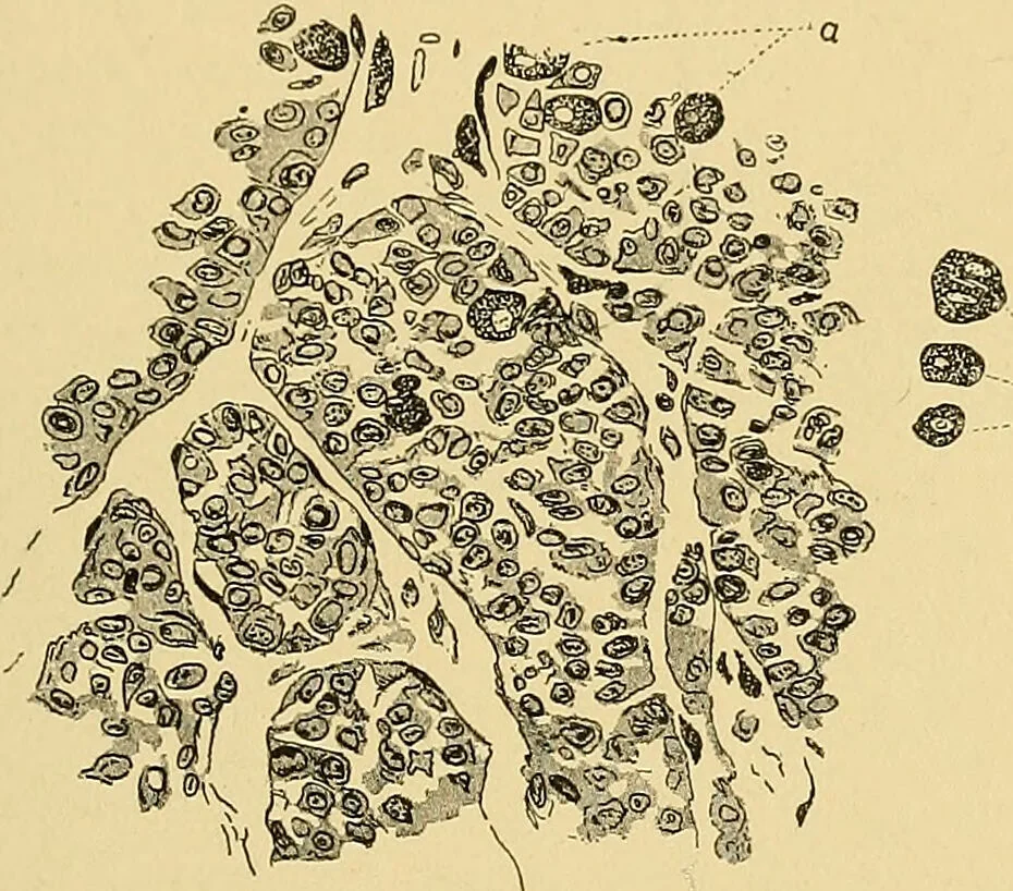 An illustration from A text-book of pathology for students of medicine / by J. George Adami and John McCrae ; illustrated with 304 engravings and 11 colored plates., 1912, leaf 297
