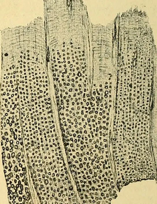 An illustration from A text-book of pathology for students of medicine / by J. George Adami and John McCrae ; illustrated with 304 engravings and 11 colored plates., 1912, leaf 320