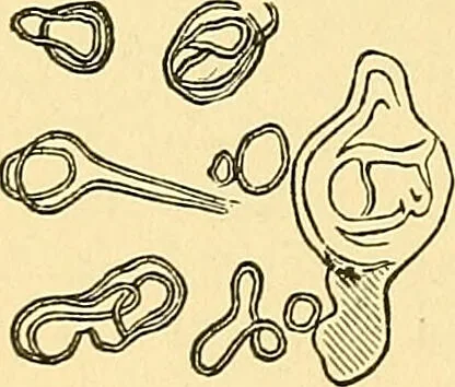 An illustration from A text-book of pathology for students of medicine / by J. George Adami and John McCrae ; illustrated with 304 engravings and 11 colored plates., 1912, leaf 334