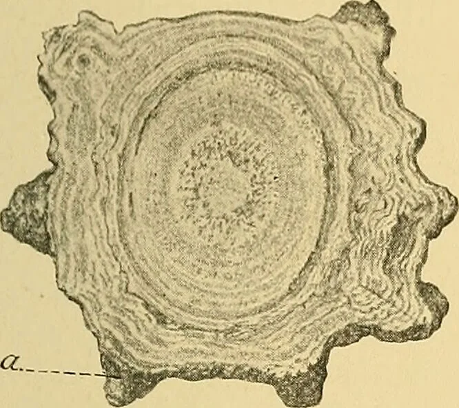An illustration from A text-book of pathology for students of medicine / by J. George Adami and John McCrae ; illustrated with 304 engravings and 11 colored plates., 1912, leaf 335