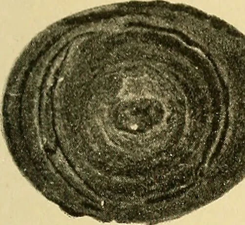 An illustration from A text-book of pathology for students of medicine / by J. George Adami and John McCrae ; illustrated with 304 engravings and 11 colored plates., 1912, leaf 337