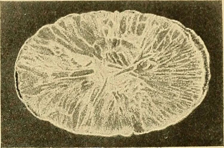 An illustration from A text-book of pathology for students of medicine / by J. George Adami and John McCrae ; illustrated with 304 engravings and 11 colored plates., 1912, leaf 337