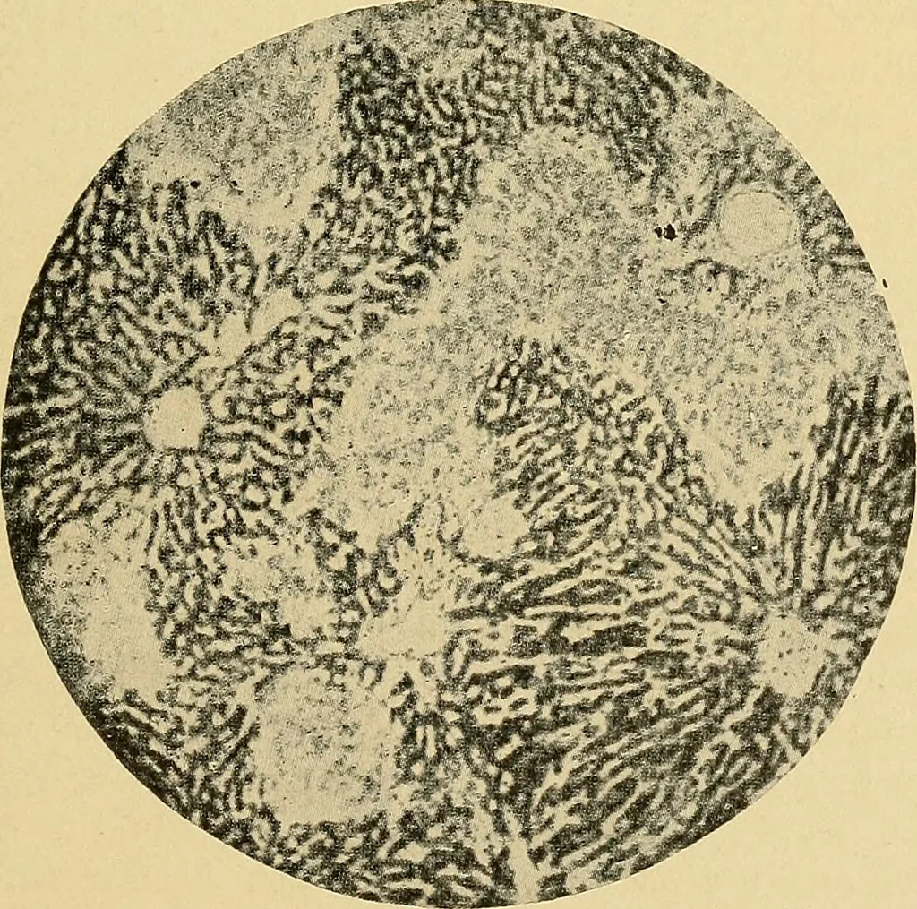 An illustration from A text-book of pathology for students of medicine / by J. George Adami and John McCrae ; illustrated with 304 engravings and 11 colored plates., 1912, leaf 345