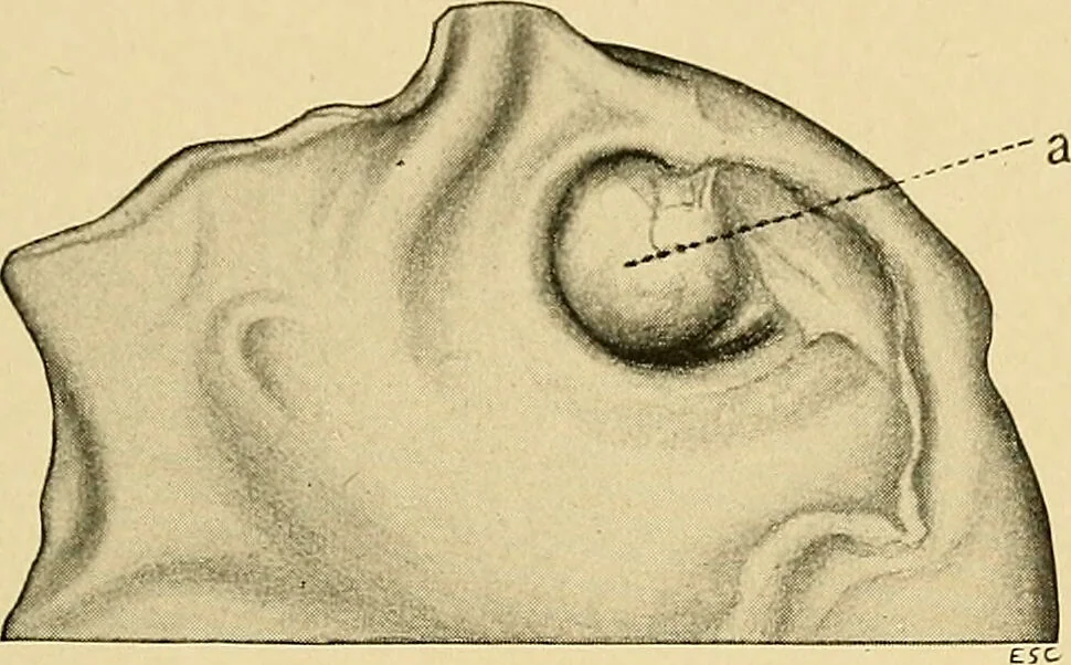 An illustration from A text-book of pathology for students of medicine / by J. George Adami and John McCrae ; illustrated with 304 engravings and 11 colored plates., 1912, leaf 367
