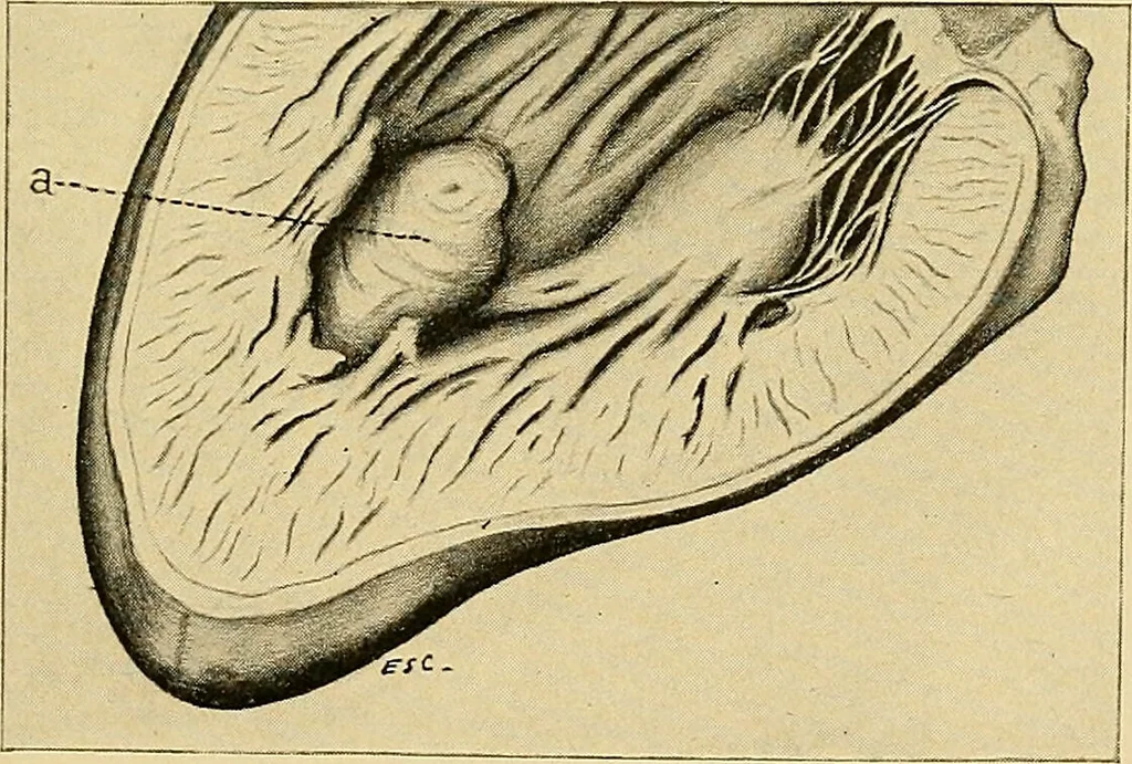 An illustration from A text-book of pathology for students of medicine / by J. George Adami and John McCrae ; illustrated with 304 engravings and 11 colored plates., 1912, leaf 367