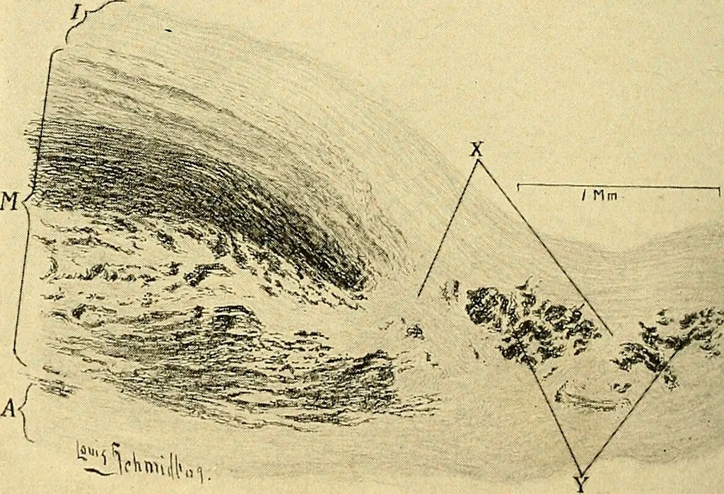 An illustration from A text-book of pathology for students of medicine / by J. George Adami and John McCrae ; illustrated with 304 engravings and 11 colored plates., 1912, leaf 426