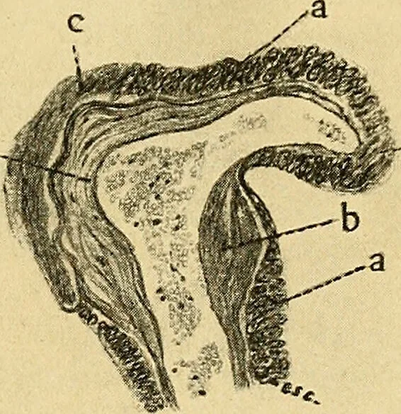 An illustration from A text-book of pathology for students of medicine / by J. George Adami and John McCrae ; illustrated with 304 engravings and 11 colored plates., 1912, leaf 427