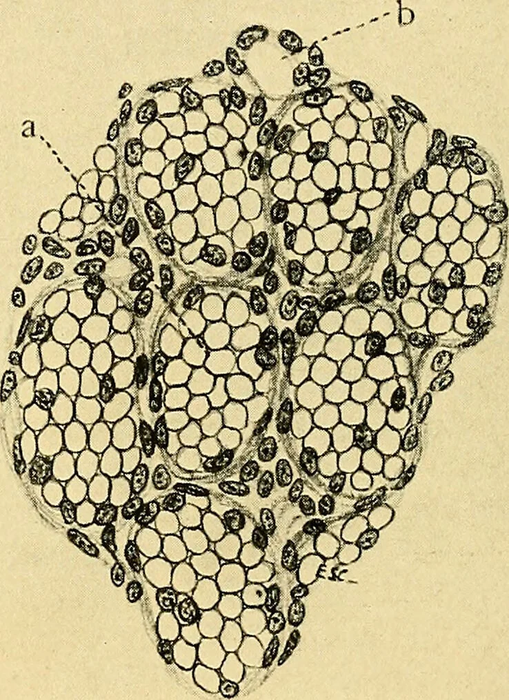 An illustration from A text-book of pathology for students of medicine / by J. George Adami and John McCrae ; illustrated with 304 engravings and 11 colored plates., 1912, leaf 440
