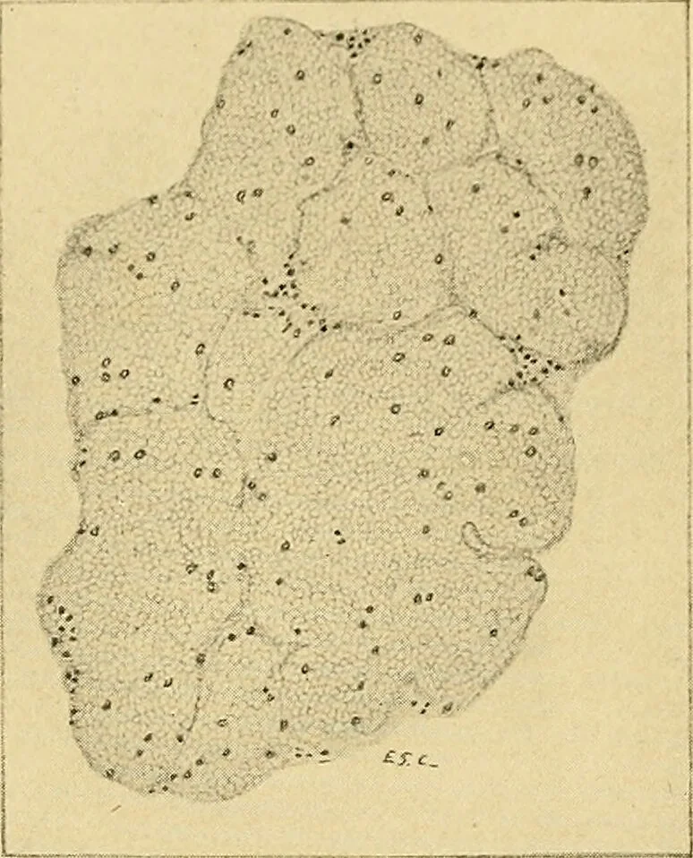 An illustration from A text-book of pathology for students of medicine / by J. George Adami and John McCrae ; illustrated with 304 engravings and 11 colored plates., 1912, leaf 473
