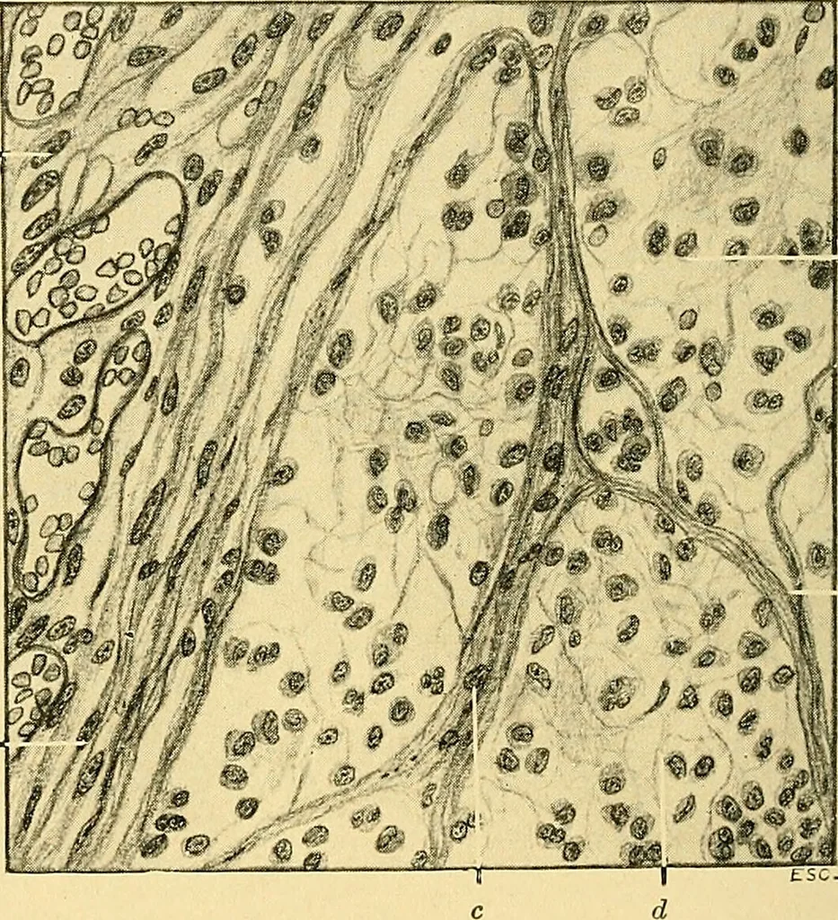 An illustration from A text-book of pathology for students of medicine / by J. George Adami and John McCrae ; illustrated with 304 engravings and 11 colored plates., 1912, leaf 492