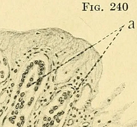 An illustration from A text-book of pathology for students of medicine / by J. George Adami and John McCrae ; illustrated with 304 engravings and 11 colored plates., 1912, leaf 572