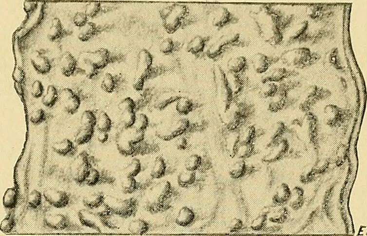 An illustration from A text-book of pathology for students of medicine / by J. George Adami and John McCrae ; illustrated with 304 engravings and 11 colored plates., 1912, leaf 573