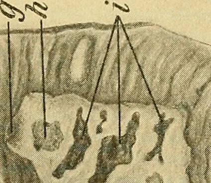 An illustration from A text-book of pathology for students of medicine / by J. George Adami and John McCrae ; illustrated with 304 engravings and 11 colored plates., 1912, leaf 575