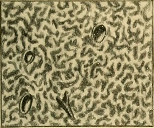 An illustration from A text-book of pathology for students of medicine / by J. George Adami and John McCrae ; illustrated with 304 engravings and 11 colored plates., 1912, leaf 595