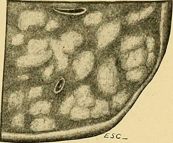 An illustration from A text-book of pathology for students of medicine / by J. George Adami and John McCrae ; illustrated with 304 engravings and 11 colored plates., 1912, leaf 601