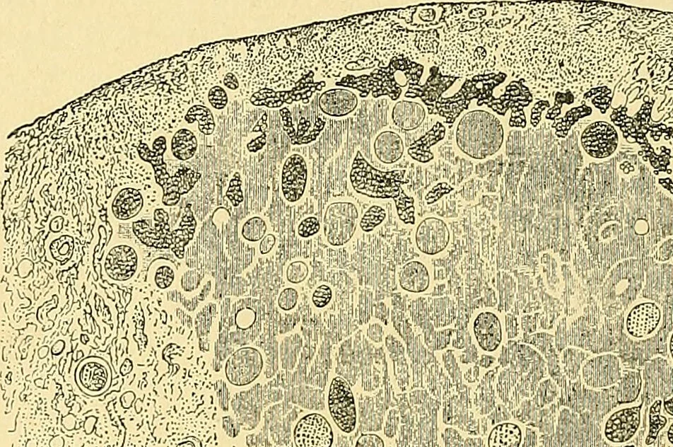 An illustration from A text-book of pathology for students of medicine / by J. George Adami and John McCrae ; illustrated with 304 engravings and 11 colored plates., 1912, leaf 634
