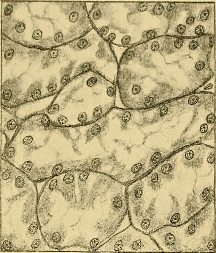 An illustration from A text-book of pathology for students of medicine / by J. George Adami and John McCrae ; illustrated with 304 engravings and 11 colored plates., 1912, leaf 635