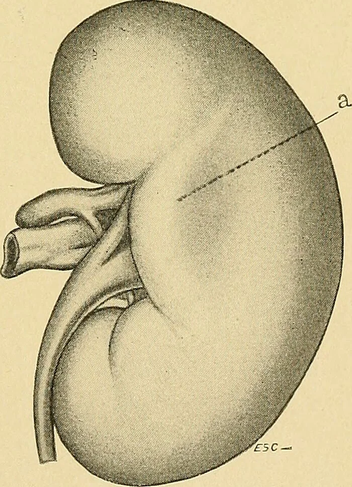 An illustration from A text-book of pathology for students of medicine / by J. George Adami and John McCrae ; illustrated with 304 engravings and 11 colored plates., 1912, leaf 637