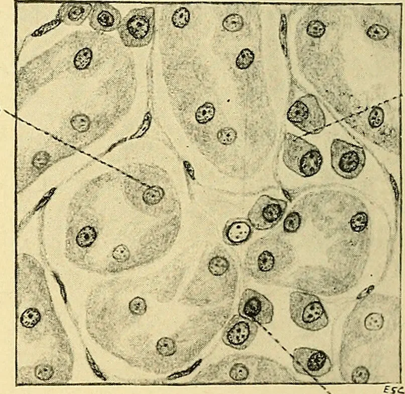 An illustration from A text-book of pathology for students of medicine / by J. George Adami and John McCrae ; illustrated with 304 engravings and 11 colored plates., 1912, leaf 640