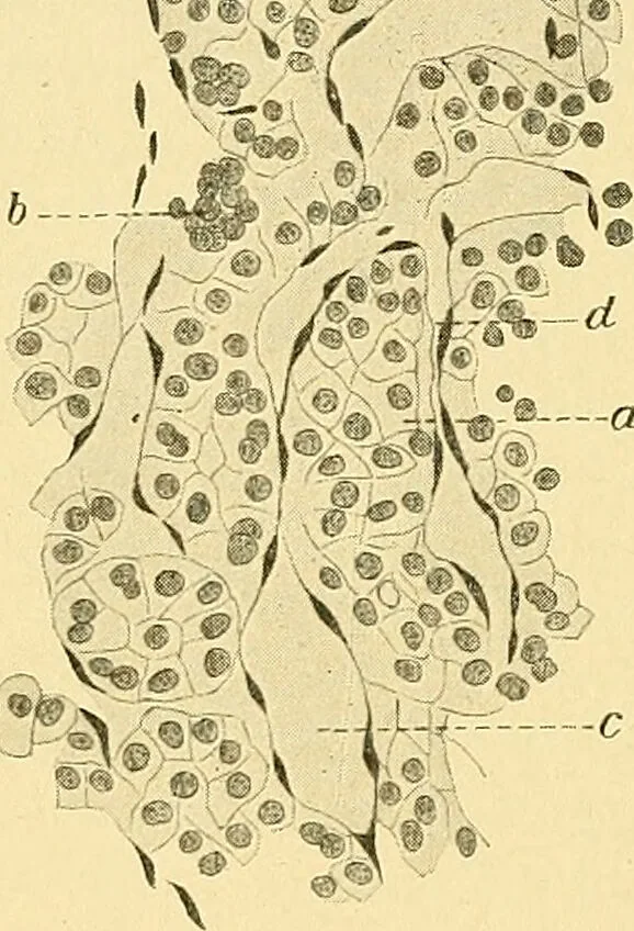 An illustration from A text-book of pathology for students of medicine / by J. George Adami and John McCrae ; illustrated with 304 engravings and 11 colored plates., 1912, leaf 646