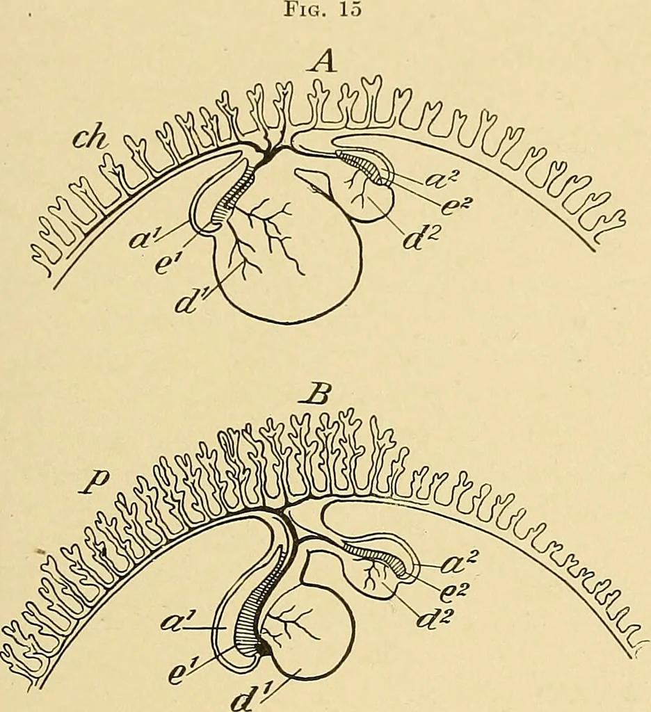 An illustration from A text-book of pathology for students of medicine / by J. George Adami and John McCrae ; illustrated with 304 engravings and 11 colored plates., 1912, leaf 65