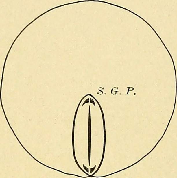 An illustration from A text-book of pathology for students of medicine / by J. George Adami and John McCrae ; illustrated with 304 engravings and 11 colored plates., 1912, leaf 68