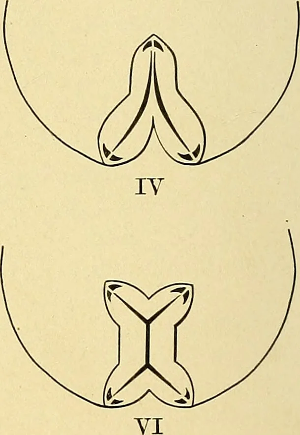 An illustration from A text-book of pathology for students of medicine / by J. George Adami and John McCrae ; illustrated with 304 engravings and 11 colored plates., 1912, leaf 68