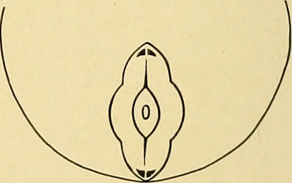 An illustration from A text-book of pathology for students of medicine / by J. George Adami and John McCrae ; illustrated with 304 engravings and 11 colored plates., 1912, leaf 68