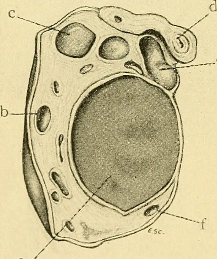 An illustration from A text-book of pathology for students of medicine / by J. George Adami and John McCrae ; illustrated with 304 engravings and 11 colored plates., 1912, leaf 680