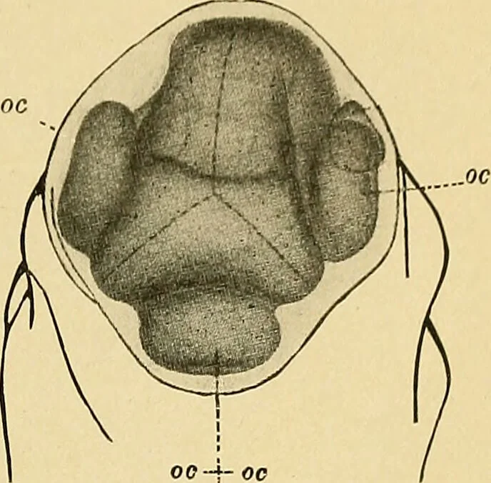 An illustration from A text-book of pathology for students of medicine / by J. George Adami and John McCrae ; illustrated with 304 engravings and 11 colored plates., 1912, leaf 69