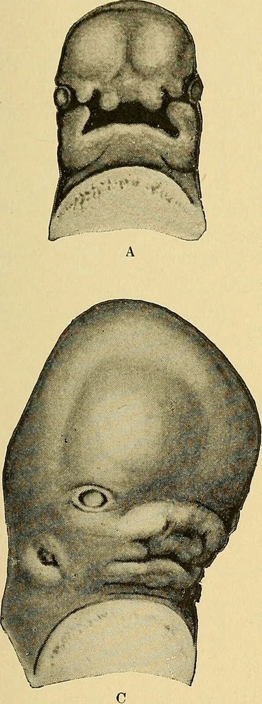 An illustration from A text-book of pathology for students of medicine / by J. George Adami and John McCrae ; illustrated with 304 engravings and 11 colored plates., 1912, leaf 75