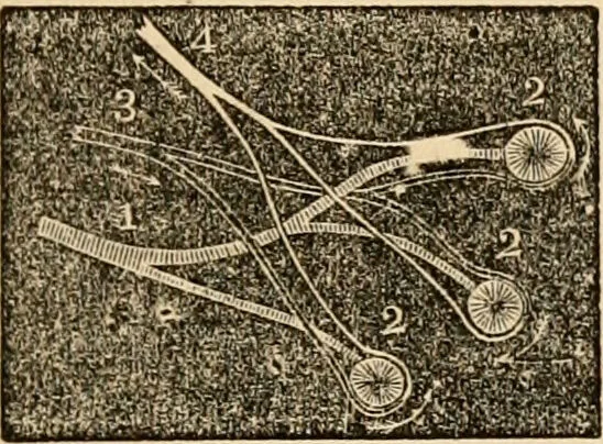 An illustration from The household physician : for the use of families, planters, seamen, and travellers ; being a brief description, in plain language, of all the diseases of men, women, and children, with the newest and most approved methods of curing them / by Ira Warren., 1866, leaf 119