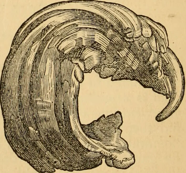 An illustration from The household physician : for the use of families, planters, seamen, and travellers ; being a brief description, in plain language, of all the diseases of men, women, and children, with the newest and most approved methods of curing them / by Ira Warren., 1866, leaf 166
