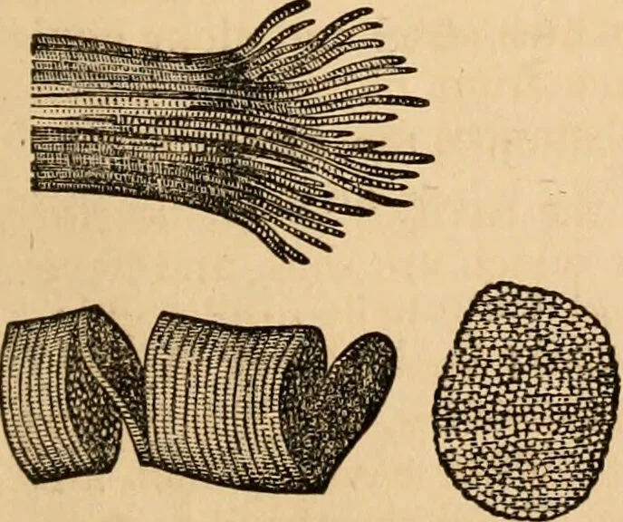 An illustration from The household physician : for the use of families, planters, seamen, and travellers ; being a brief description, in plain language, of all the diseases of men, women, and children, with the newest and most approved methods of curing them / by Ira Warren., 1866, leaf 27