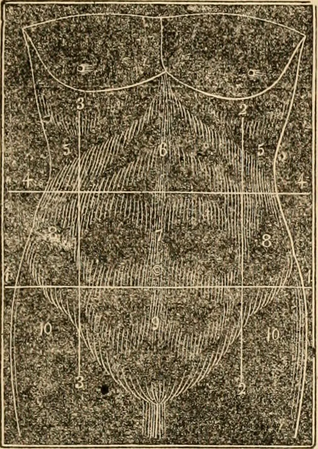 An illustration from The household physician : for the use of families, planters, seamen, and travellers ; being a brief description, in plain language, of all the diseases of men, women, and children, with the newest and most approved methods of curing them / by Ira Warren., 1866, leaf 281