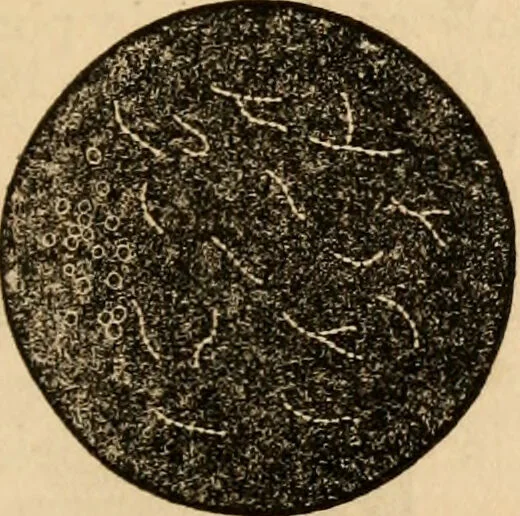 An illustration from The household physician : for the use of families, planters, seamen, and travellers ; being a brief description, in plain language, of all the diseases of men, women, and children, with the newest and most approved methods of curing them / by Ira Warren., 1866, leaf 291