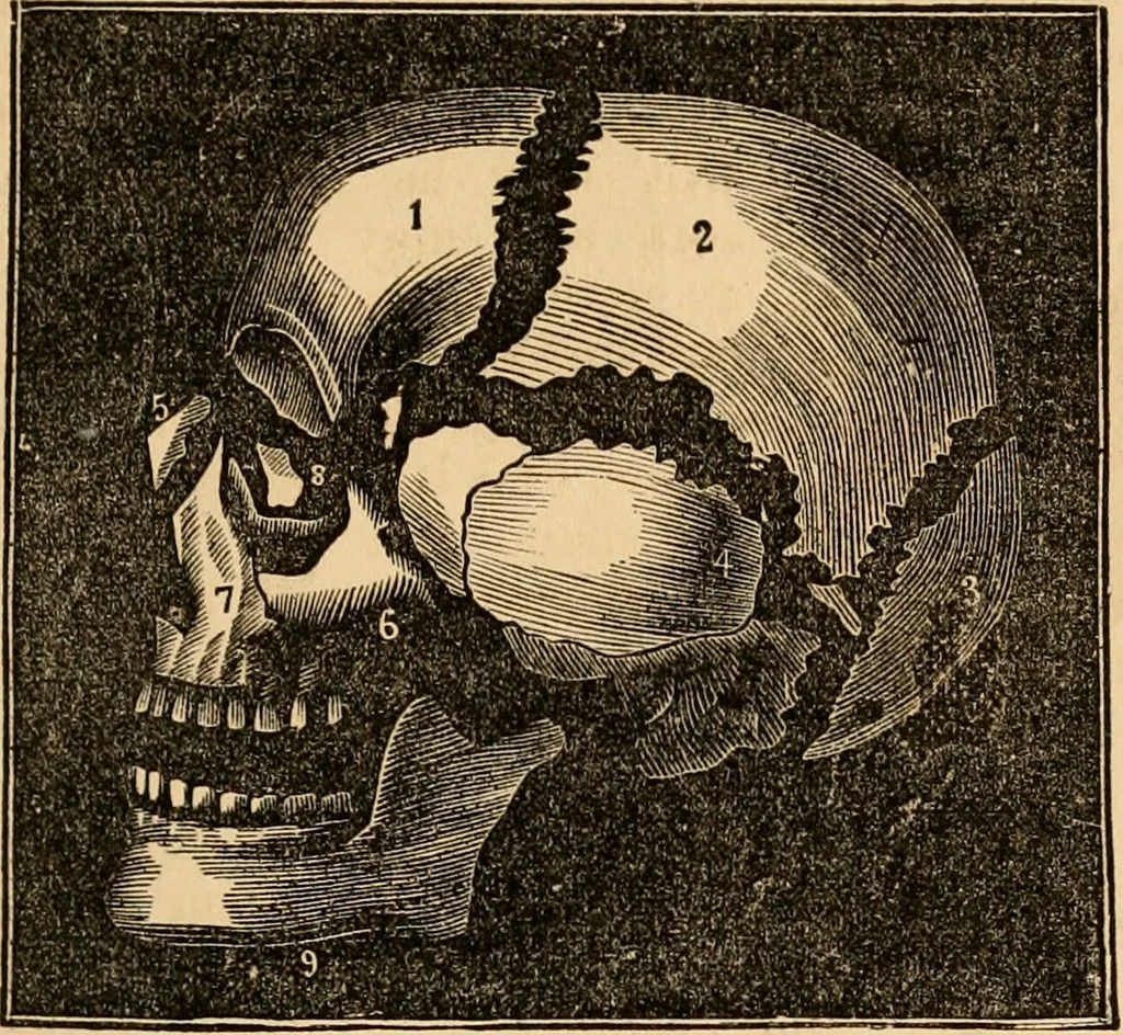 An illustration from The household physician : for the use of families, planters, seamen, and travellers ; being a brief description, in plain language, of all the diseases of men, women, and children, with the newest and most approved methods of curing them / by Ira Warren., 1866, leaf 31