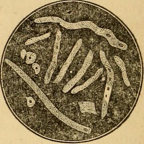 An illustration from The household physician : for the use of families, planters, seamen, and travellers ; being a brief description, in plain language, of all the diseases of men, women, and children, with the newest and most approved methods of curing them / by Ira Warren., 1866, leaf 318