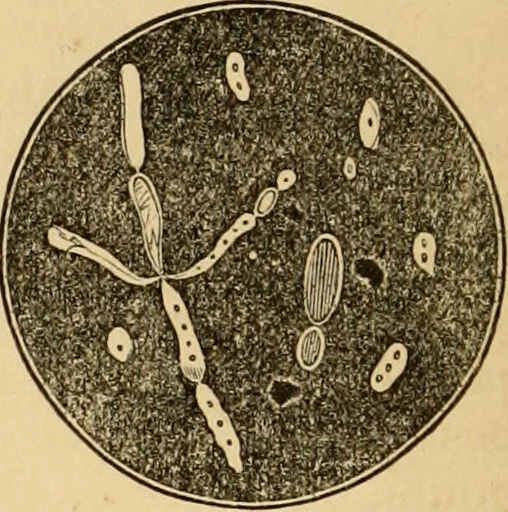 An illustration from The household physician : for the use of families, planters, seamen, and travellers ; being a brief description, in plain language, of all the diseases of men, women, and children, with the newest and most approved methods of curing them / by Ira Warren., 1866, leaf 320