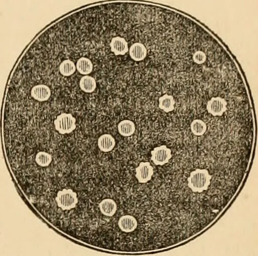 An illustration from The household physician : for the use of families, planters, seamen, and travellers ; being a brief description, in plain language, of all the diseases of men, women, and children, with the newest and most approved methods of curing them / by Ira Warren., 1866, leaf 321