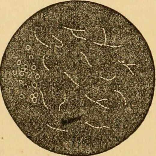 An illustration from The household physician : for the use of families, planters, seamen, and travellers ; being a brief description, in plain language, of all the diseases of men, women, and children, with the newest and most approved methods of curing them / by Ira Warren., 1866, leaf 326