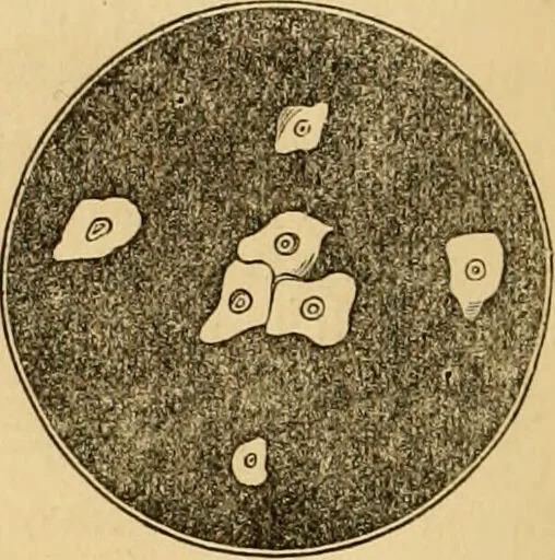 An illustration from The household physician : for the use of families, planters, seamen, and travellers ; being a brief description, in plain language, of all the diseases of men, women, and children, with the newest and most approved methods of curing them / by Ira Warren., 1866, leaf 330