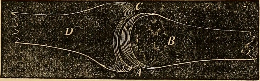 An illustration from The household physician : for the use of families, planters, seamen, and travellers ; being a brief description, in plain language, of all the diseases of men, women, and children, with the newest and most approved methods of curing them / by Ira Warren., 1866, leaf 35