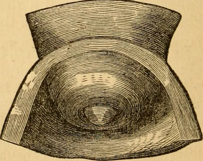 An illustration from The household physician : for the use of families, planters, seamen, and travellers ; being a brief description, in plain language, of all the diseases of men, women, and children, with the newest and most approved methods of curing them / by Ira Warren., 1866, leaf 380