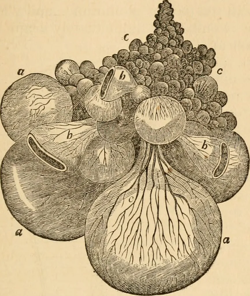 An illustration from The household physician : for the use of families, planters, seamen, and travellers ; being a brief description, in plain language, of all the diseases of men, women, and children, with the newest and most approved methods of curing them / by Ira Warren., 1866, leaf 399