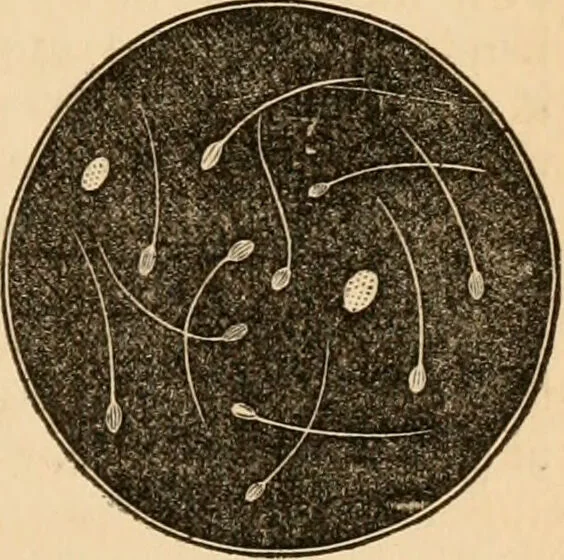 An illustration from The household physician : for the use of families, planters, seamen, and travellers ; being a brief description, in plain language, of all the diseases of men, women, and children, with the newest and most approved methods of curing them / by Ira Warren., 1866, leaf 399
