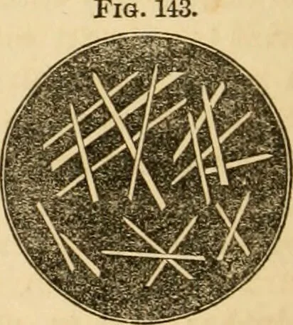 An illustration from The household physician : for the use of families, planters, seamen, and travellers ; being a brief description, in plain language, of all the diseases of men, women, and children, with the newest and most approved methods of curing them / by Ira Warren., 1866, leaf 444