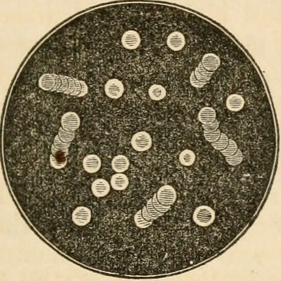 An illustration from The household physician : for the use of families, planters, seamen, and travellers ; being a brief description, in plain language, of all the diseases of men, women, and children, with the newest and most approved methods of curing them / by Ira Warren., 1866, leaf 453