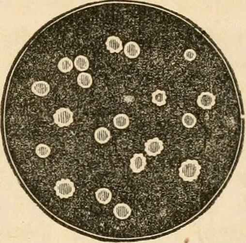 An illustration from The household physician : for the use of families, planters, seamen, and travellers ; being a brief description, in plain language, of all the diseases of men, women, and children, with the newest and most approved methods of curing them / by Ira Warren., 1866, leaf 453