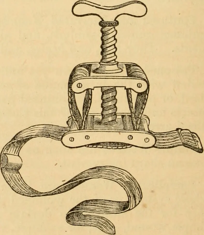 An illustration from The household physician : for the use of families, planters, seamen, and travellers ; being a brief description, in plain language, of all the diseases of men, women, and children, with the newest and most approved methods of curing them / by Ira Warren., 1866, leaf 464